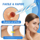 Kit traitement des acrochordons