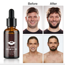 Kit complet de croissance pour barbe