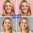 14x Bandes blanchiment dentaire