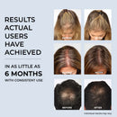 Peigne de massage infrarouge - Anti-Chute