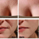 Patchs réutilisables anti-rides - 16 pièces