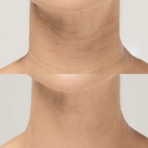 Patchs réutilisables anti-rides - 16 pièces