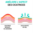 2x Patchs réutilisables de silicone pour cicatrices et vergetures