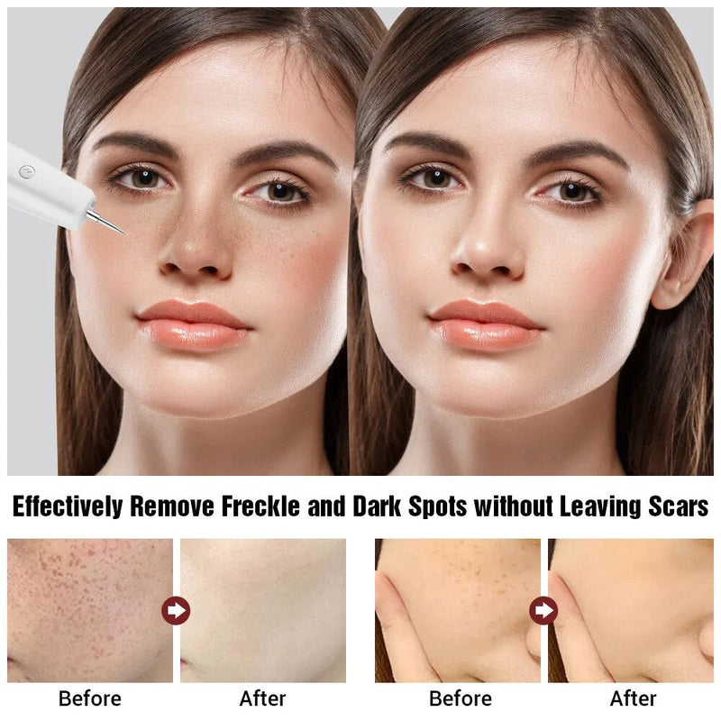 Perfect Skin - Stylo Anti Taches