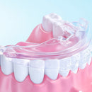 Pack de 3 Gouttières d'alignement dentaire