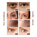 20x Patchs yeux anti-cernes Or Collagène & Acide Hyaluronique