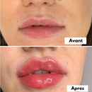 Sérum Magique pour des lèvres pulpeuses - Soins repulpant